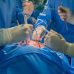 Sélectionner Transplantation : Faire battre un autre cœur… grâce à la loi Transplantation : Faire battre un autre cœur grâce à la loi