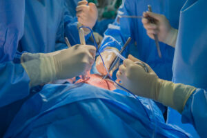 Sélectionner Transplantation : Faire battre un autre cœur… grâce à la loi Transplantation : Faire battre un autre cœur grâce à la loi