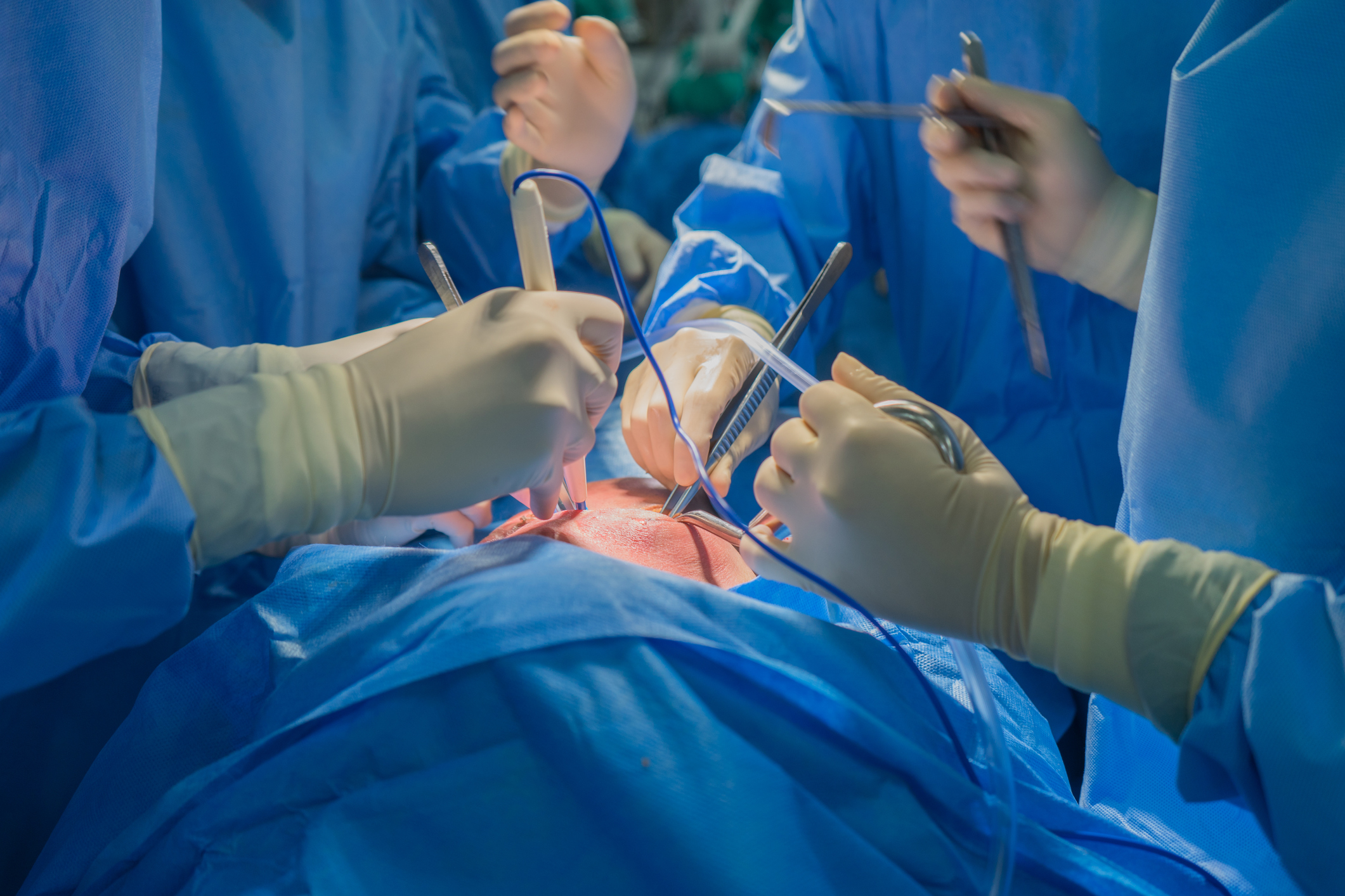 Sélectionner Transplantation : Faire battre un autre cœur… grâce à la loi Transplantation : Faire battre un autre cœur grâce à la loi